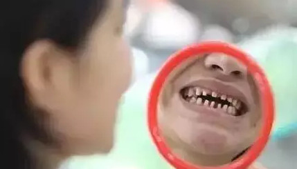 \