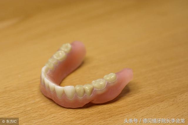 活动假牙究竟可以戴多久?