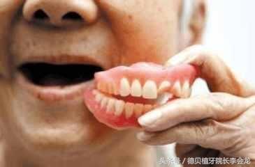 活动假牙究竟可以戴多久?