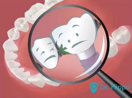 初戴活动义齿你是否也有这样的感觉?